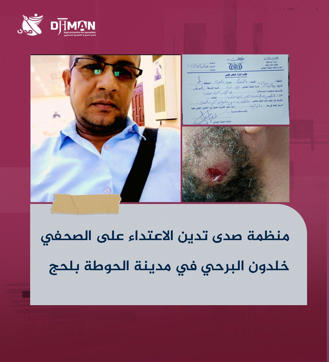 منظمة صدى تدين الاعتداء على الصحفي خلدون البرحي 